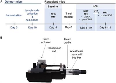 Contribution of Tissue Inflammation and Blood-Brain Barrier Disruption to Brain Softening in a Mouse Model of Multiple Sclerosis